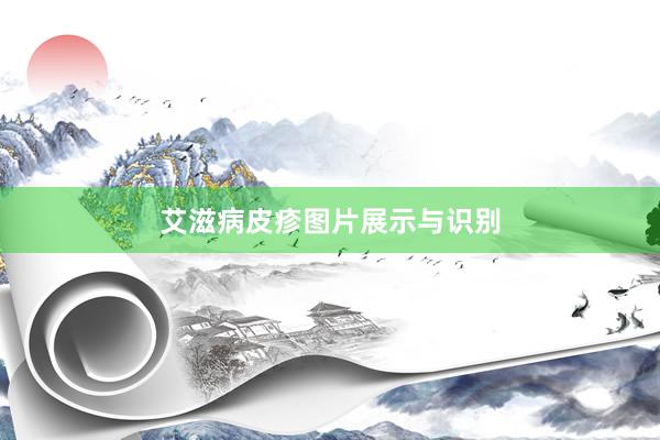 艾滋病皮疹图片展示与识别