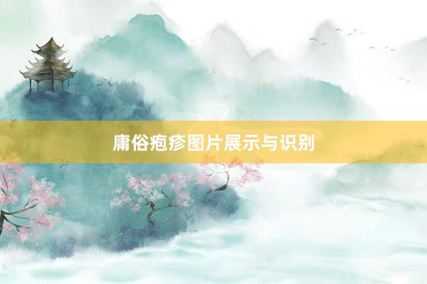 庸俗疱疹图片展示与识别
